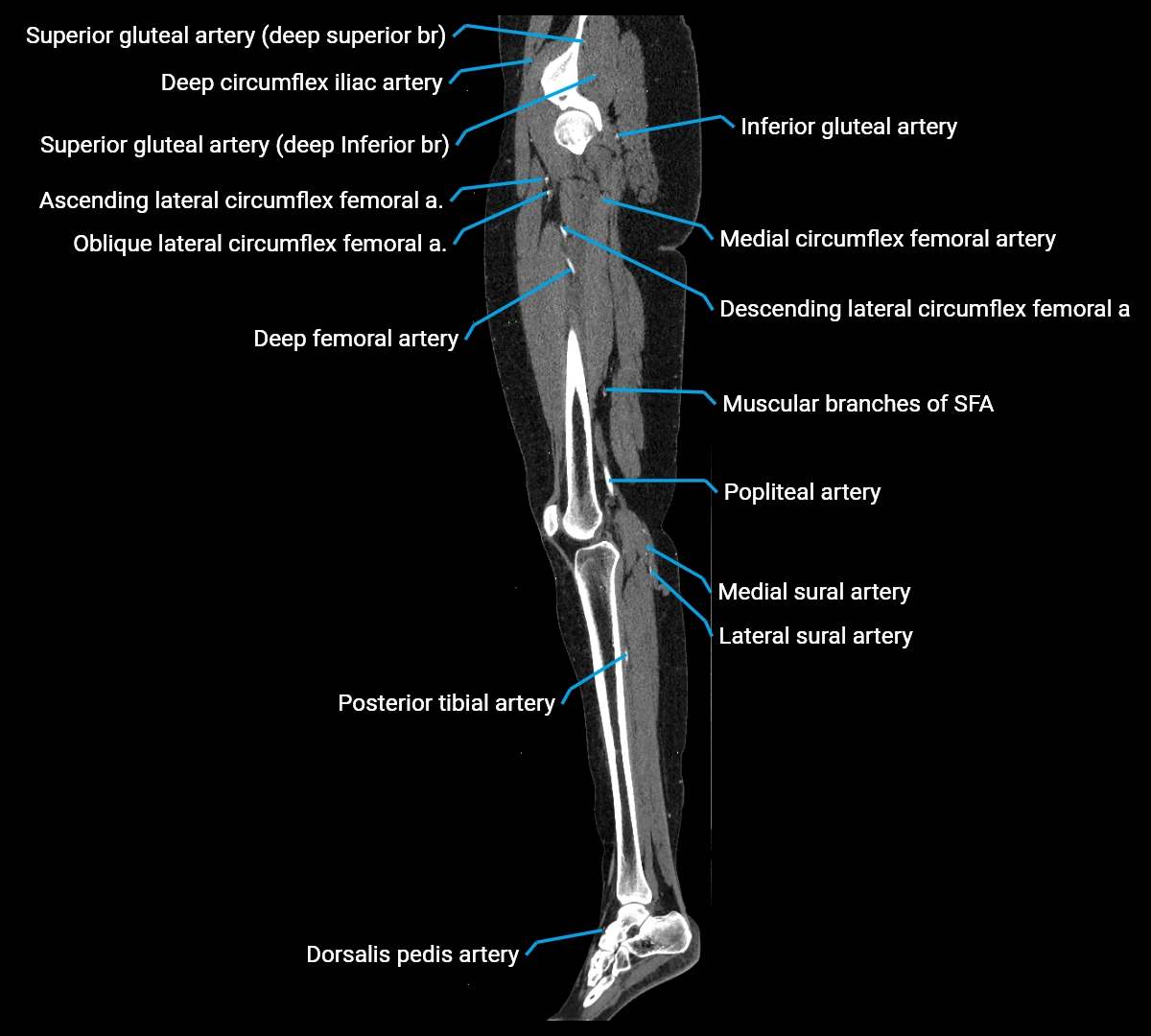 CTA lower limb sagittal cross sectional anatomy labelled image _42 (3).webp